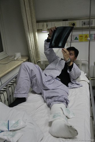 水木年华主唱缪杰踢球断腿已确诊:会留后遗症